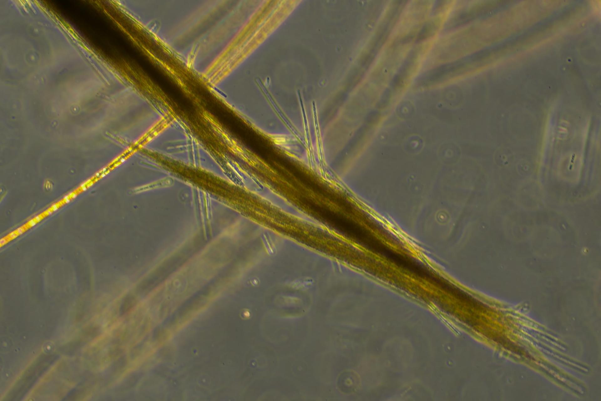 Microscopic bacteria