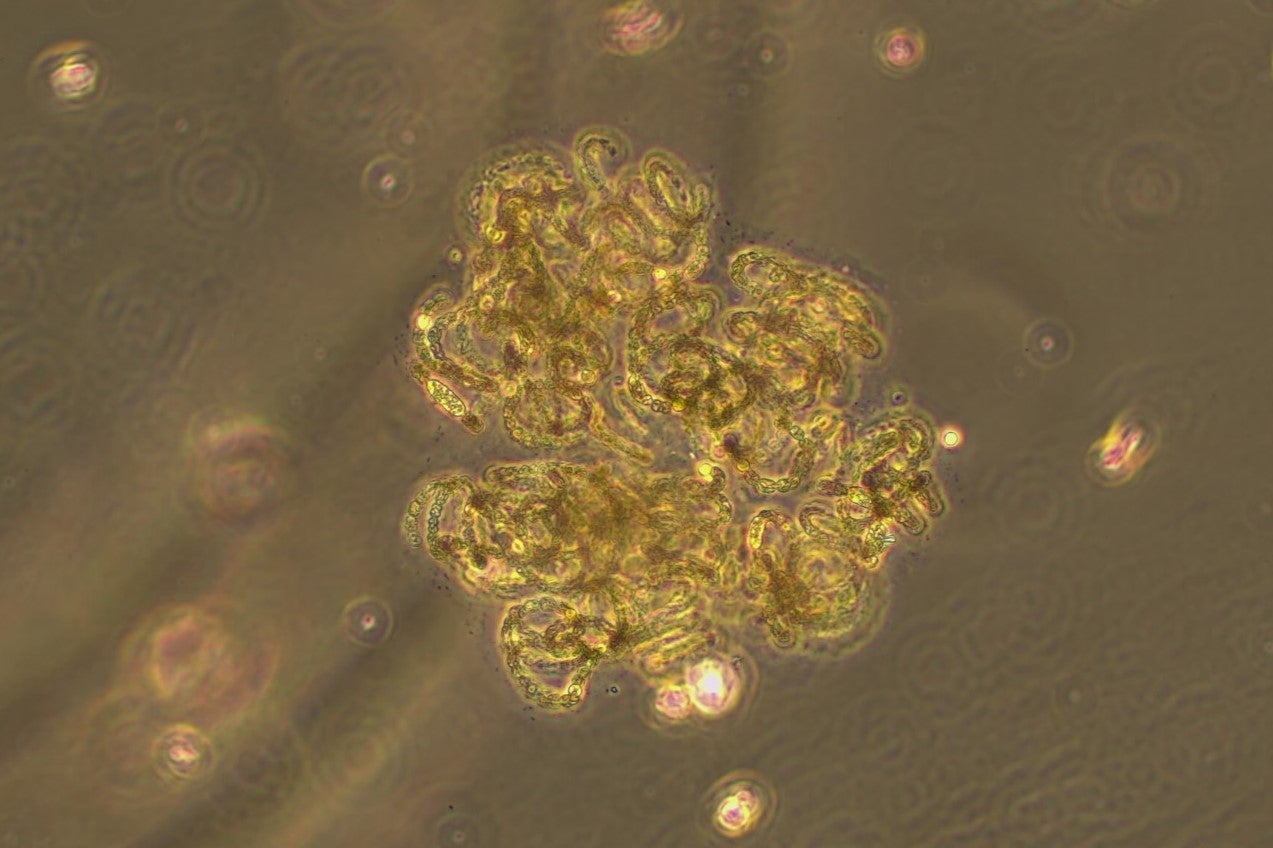 Clump of microscopic bacteria